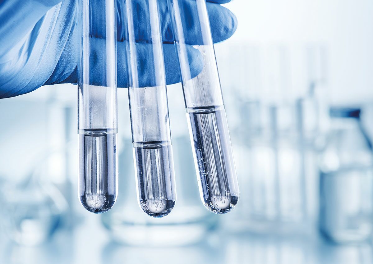 Probenvorbereitung für die EOF-Analytik