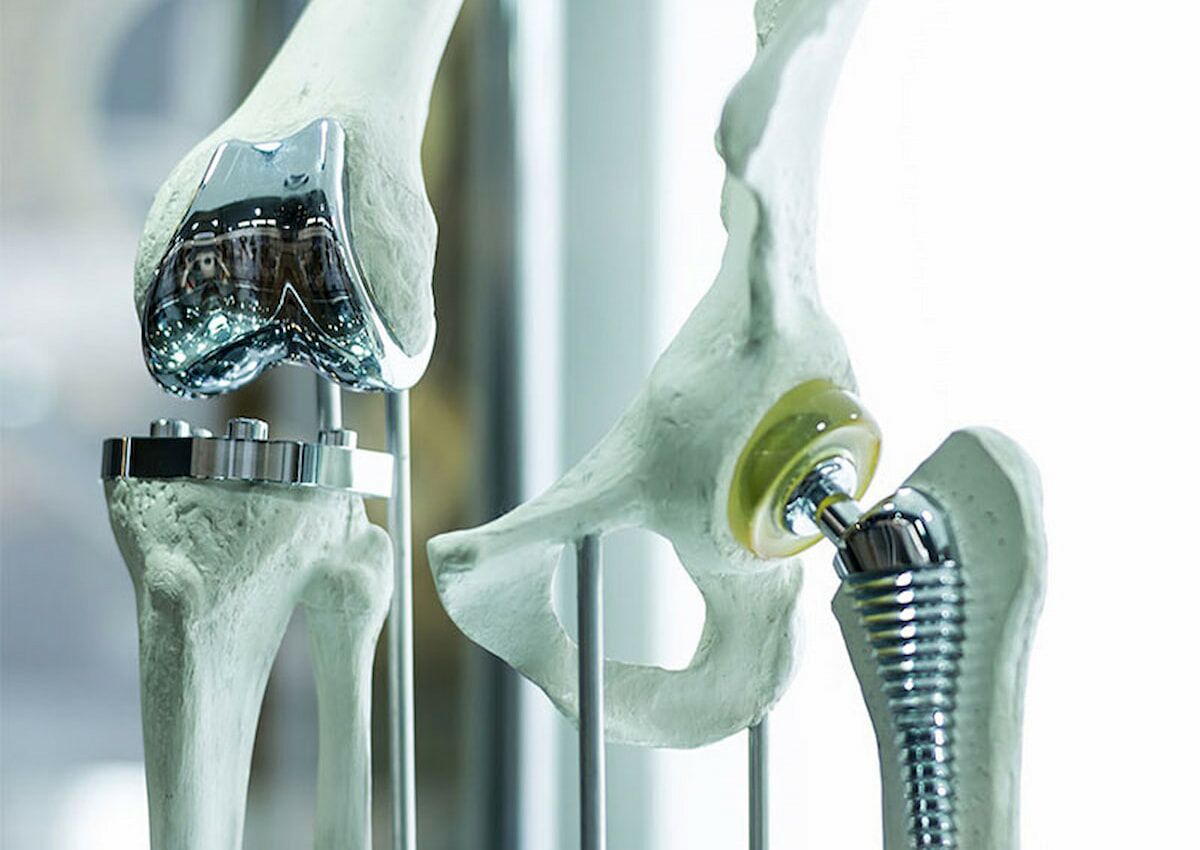 Quality analysis for medical technology