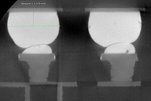 Analysis of solder joints for quality assurance